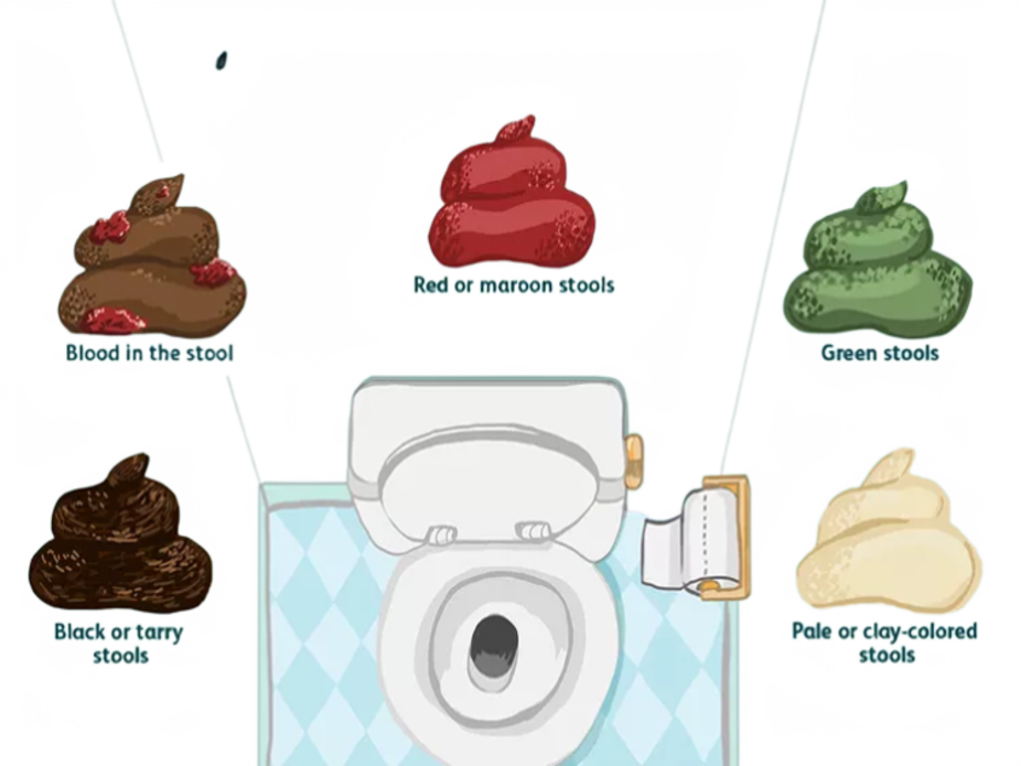 understanding-the-color-of-your-poop-and-its-health-significance