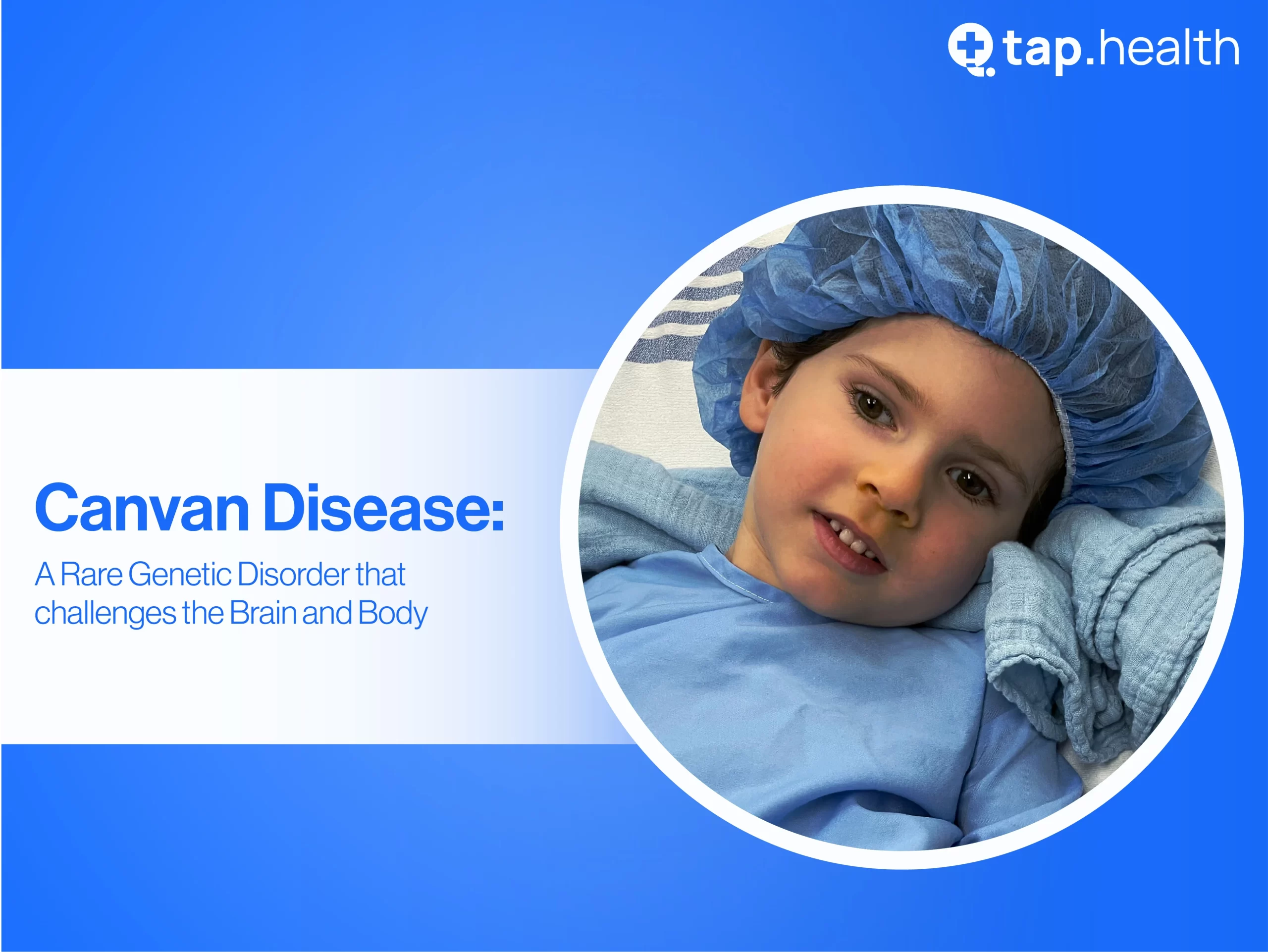 Canavan Disease: Symptoms, Diagnosis and Treatments