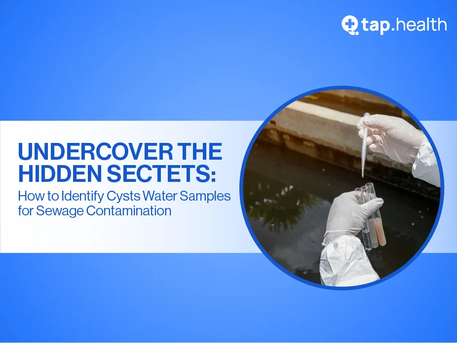 how-to-identify-cysts-in-water-samples-for-sewage-contamination