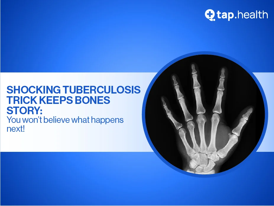 how-to-preserve-bone-structure-and-function-in-tuberculosis