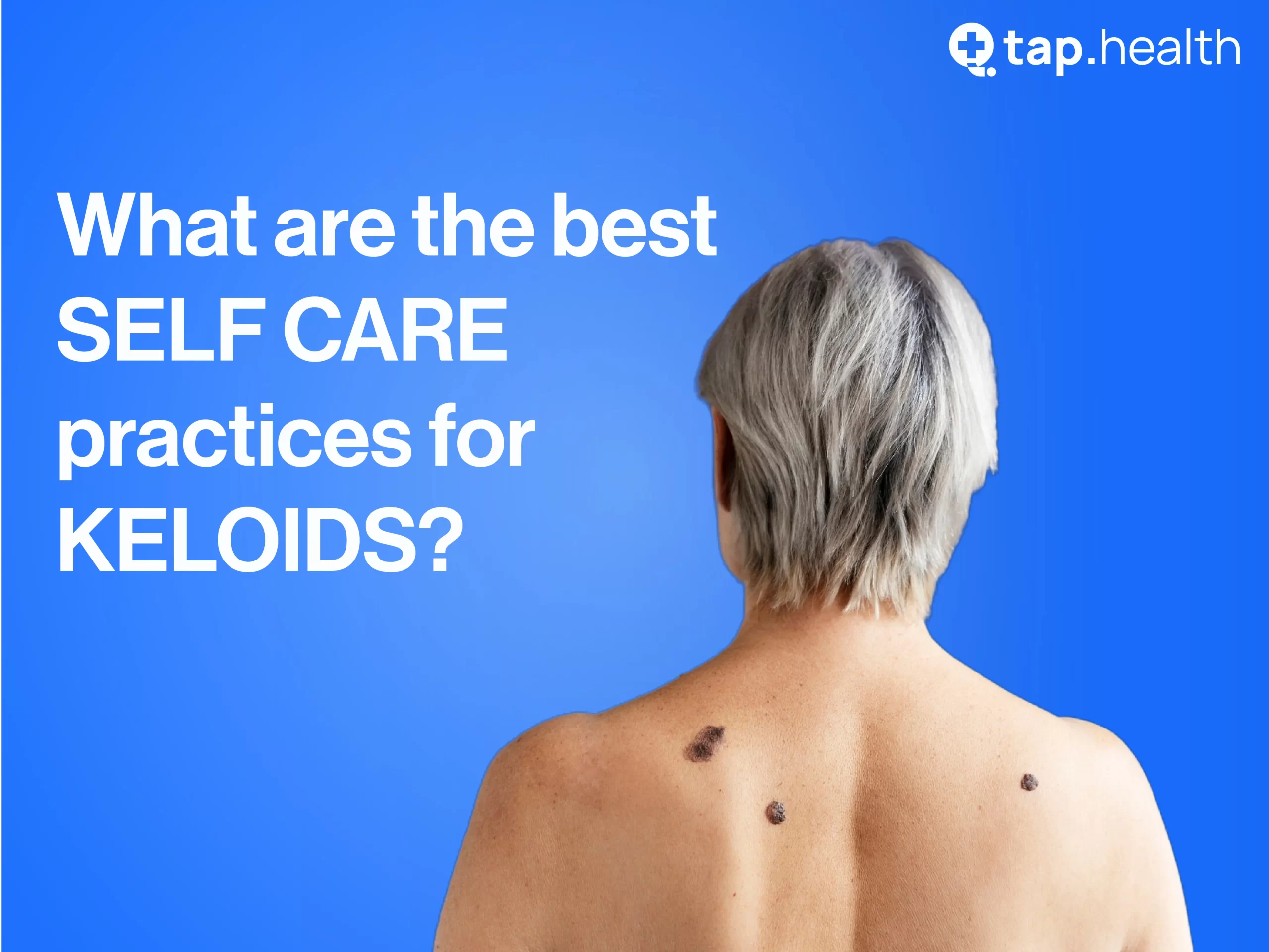 what-are-the-best-self-care-practices-for-keloids