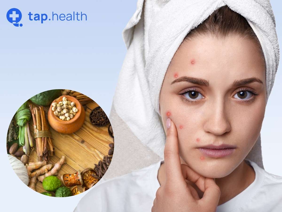 Effective Ayurvedic Treatment For Acne: Get Clearer Skin - Tap Health