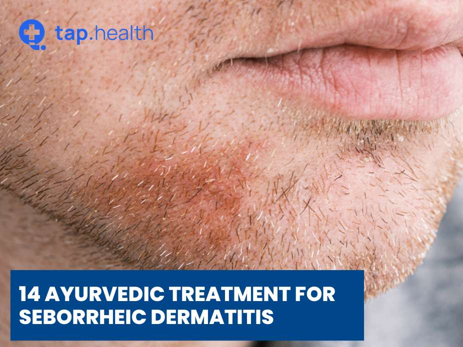 14 Ayurvedic Treatment for Seborrheic Dermatitis