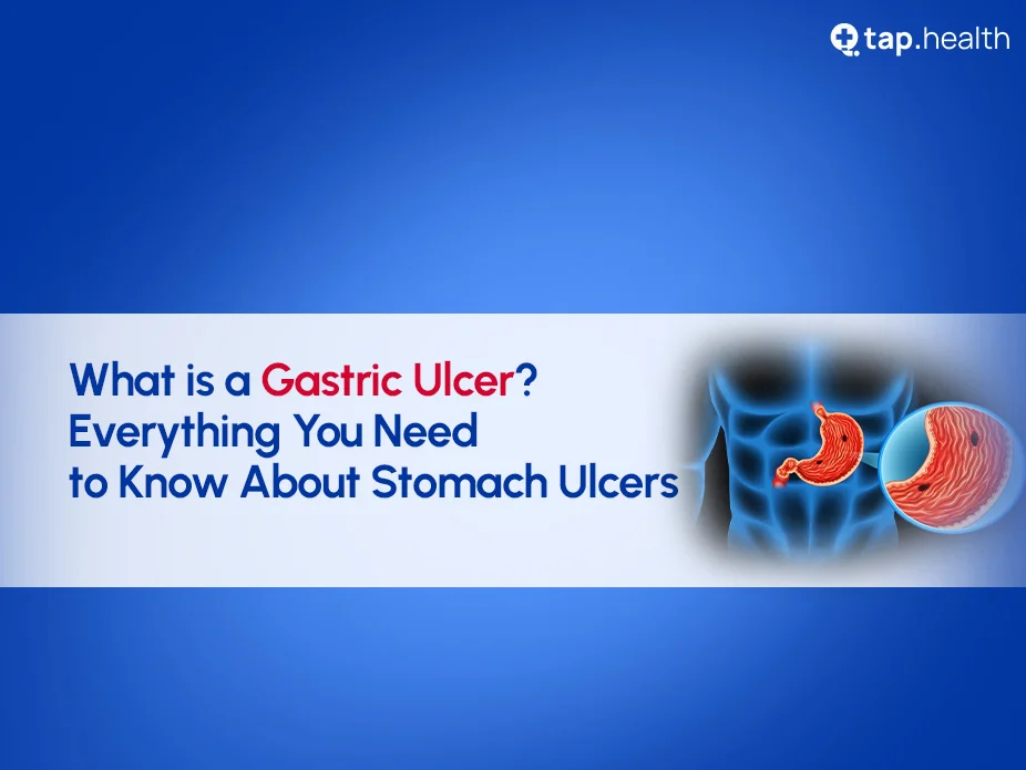 gastric-ulcer-in-hindi