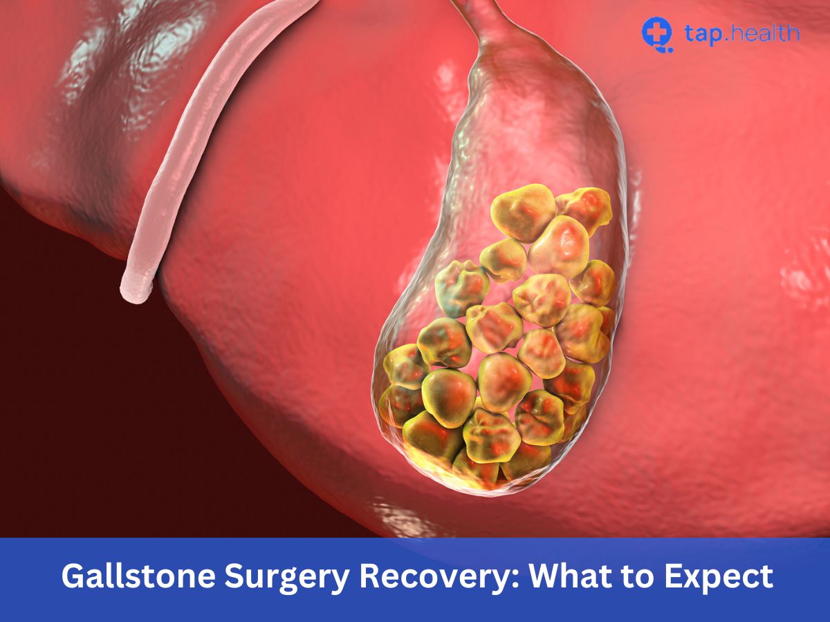 Gallstone Surgery Recovery What to Expect