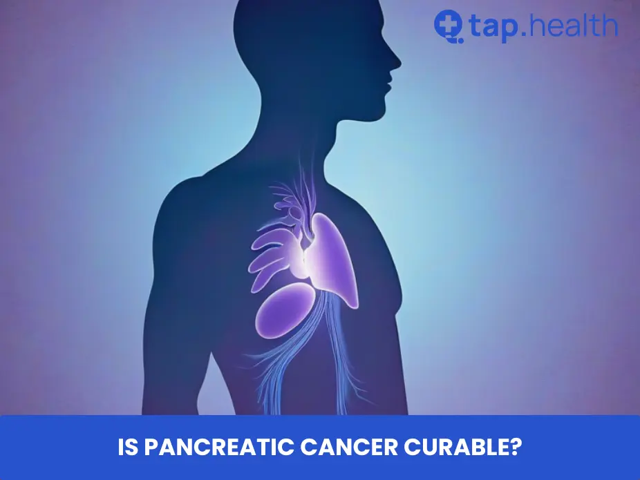 Is Pancreatic Cancer Curable