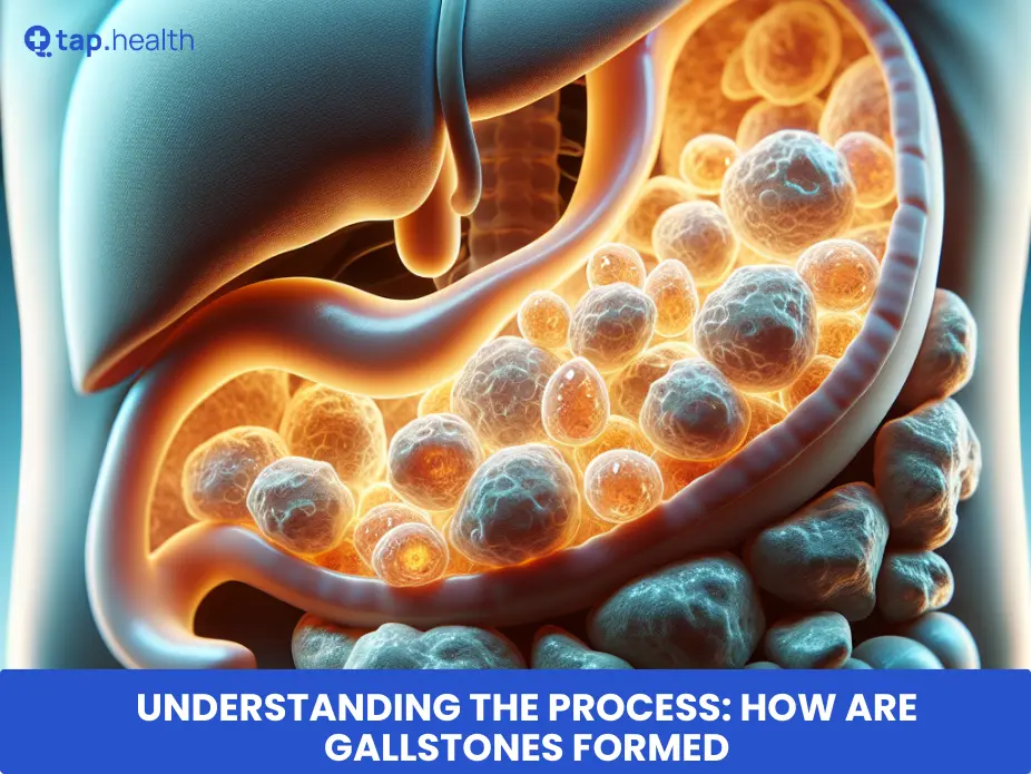 Understanding the Process How Are Gallstones Formed