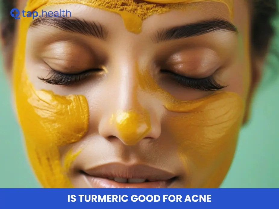 is turmeric good for acne