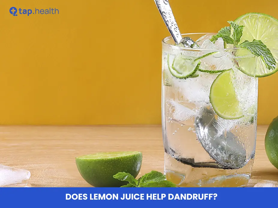 Does Lemon Juice Help Dandruff?