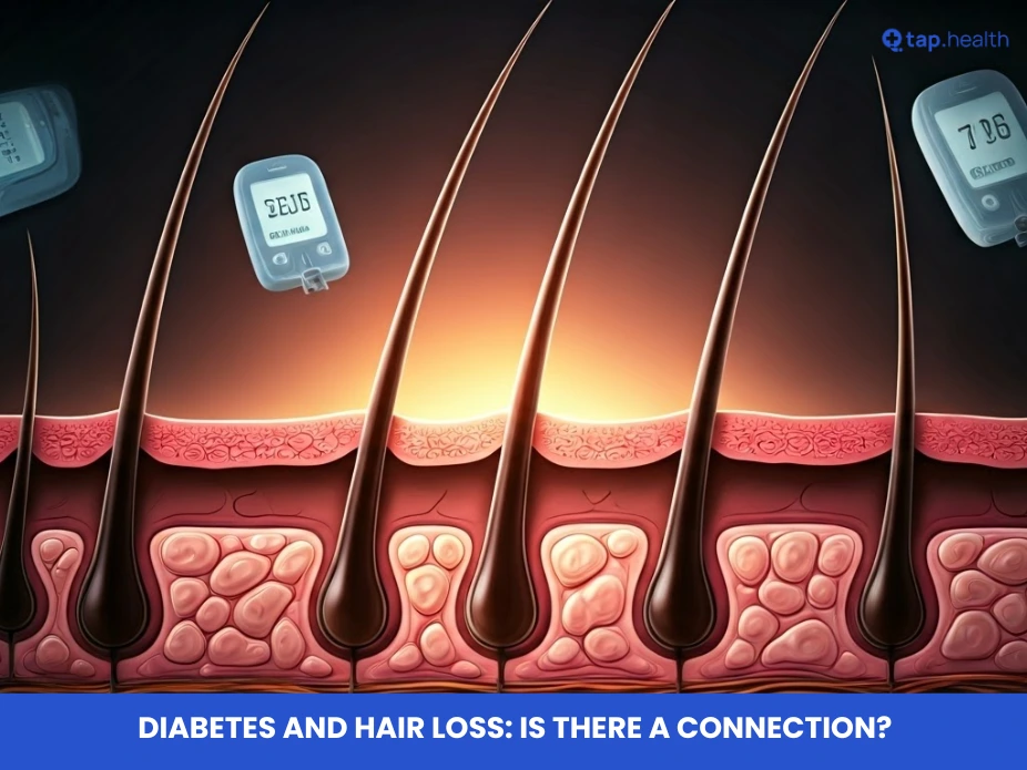 Diabetes and Hair Loss Is There a Connection