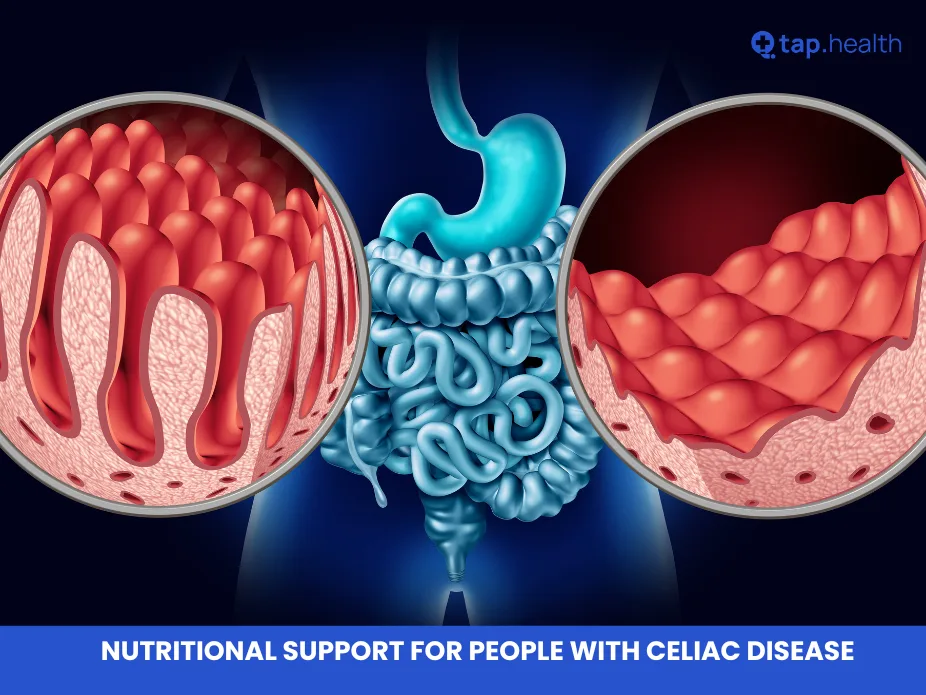 Nutritional Support for People with Celiac Disease