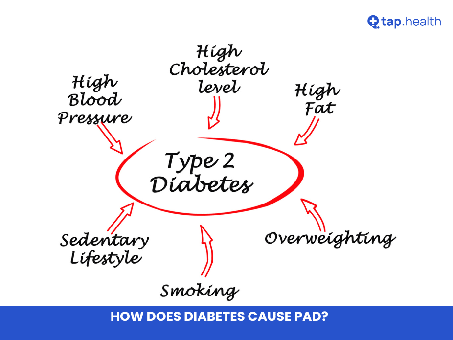 How Does Diabetes Cause PAD?