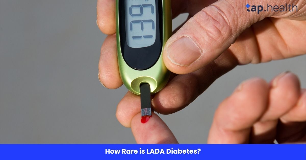 How Rare is LADA Diabetes?