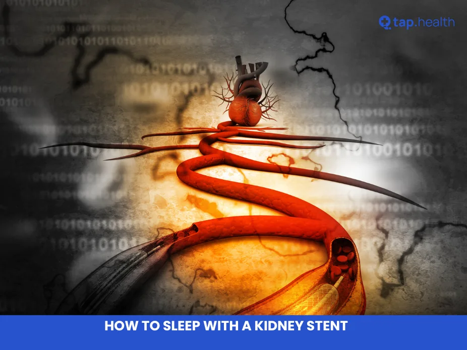 How to Sleep with a Kidney Stent