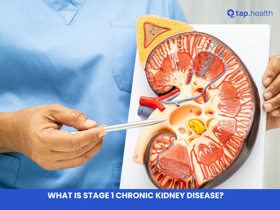 What is Stage 1 Chronic Kidney Disease?