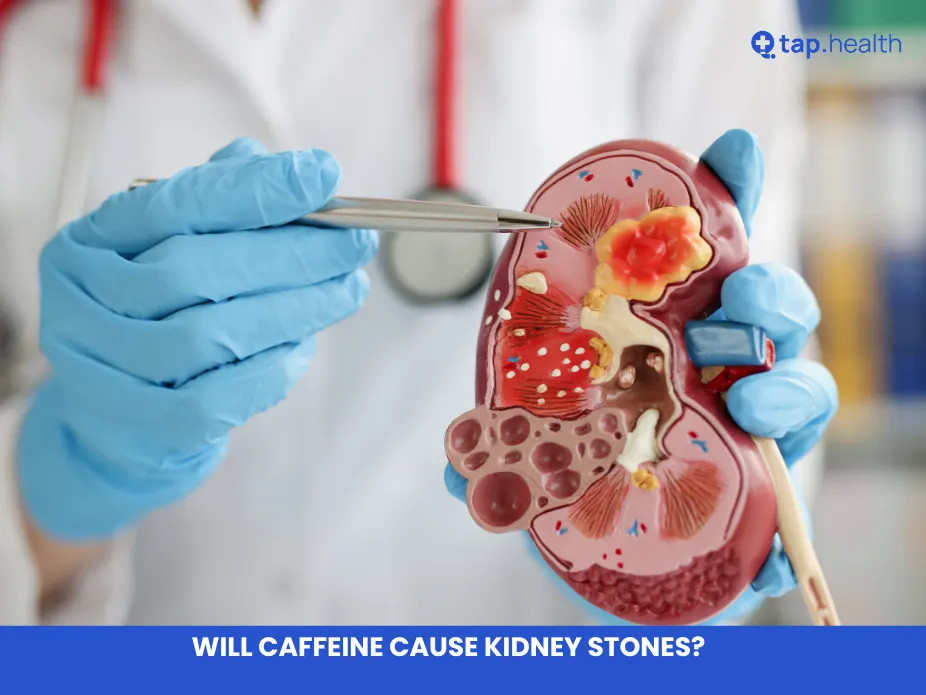 Will Caffeine Cause Kidney Stones?