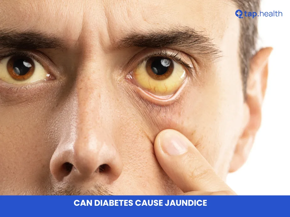 can diabetes cause jaundice