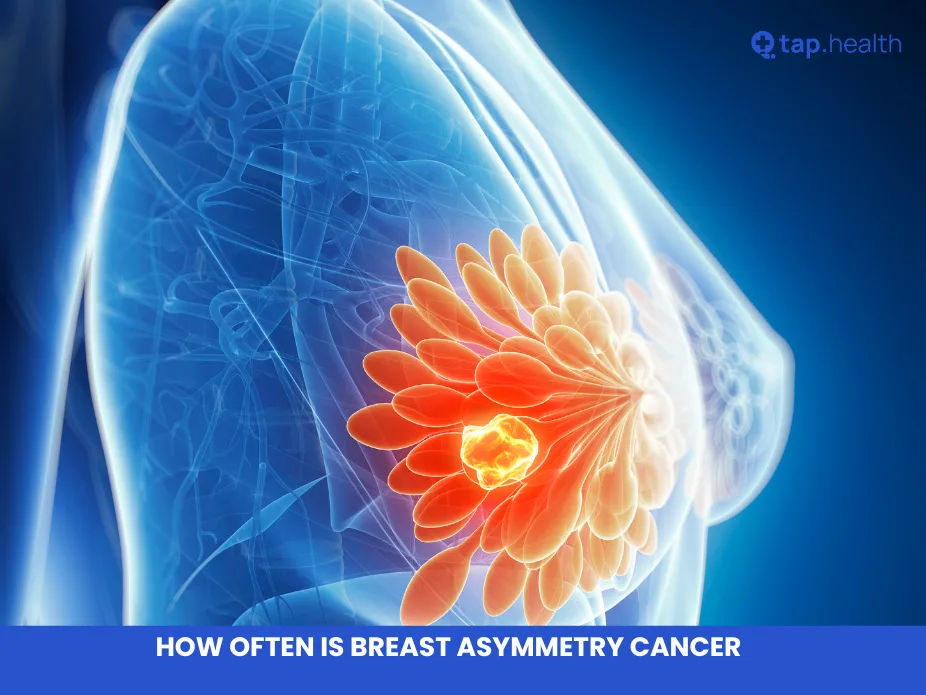 how often is breast asymmetry cancer