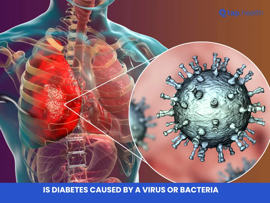 is diabetes caused by a virus or bacteria