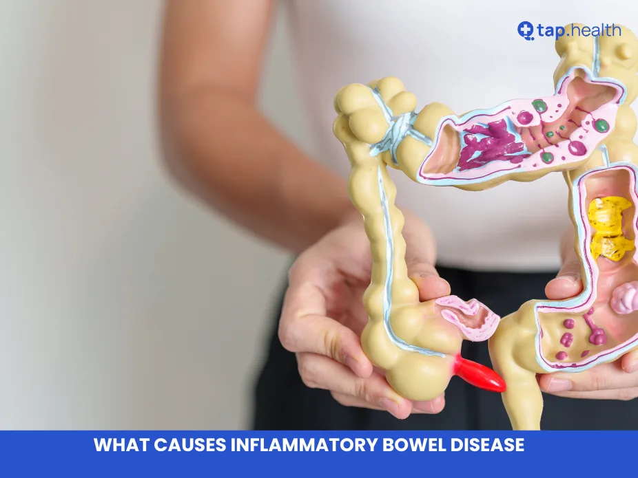 what causes inflammatory bowel disease​