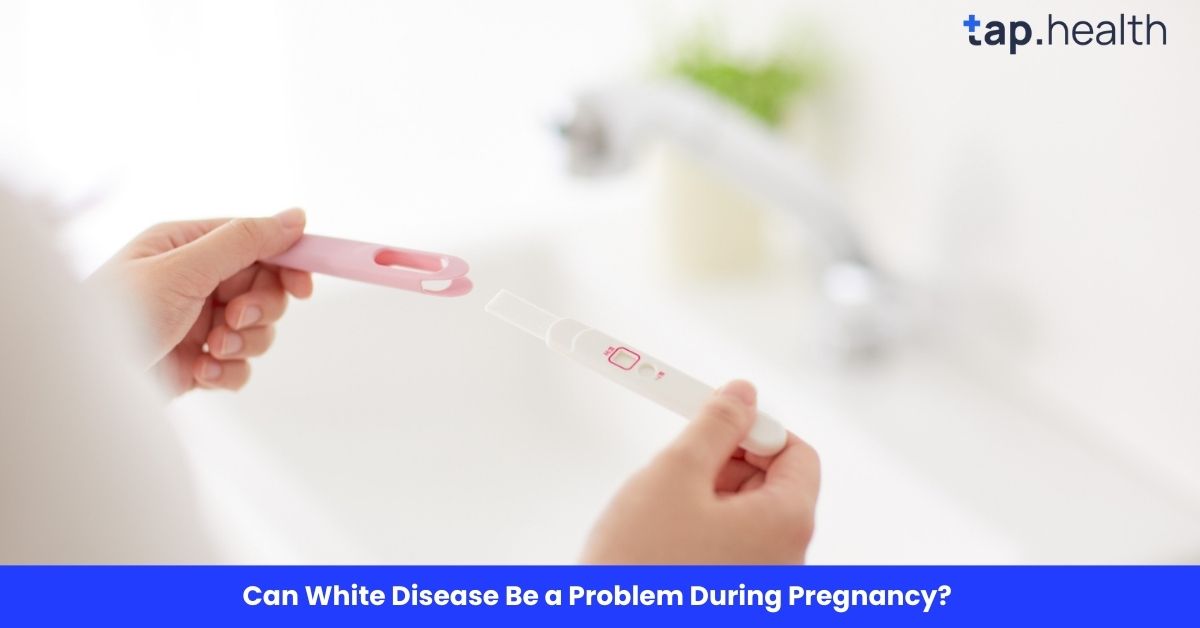 Can White Disease Be a Problem During Pregnancy?