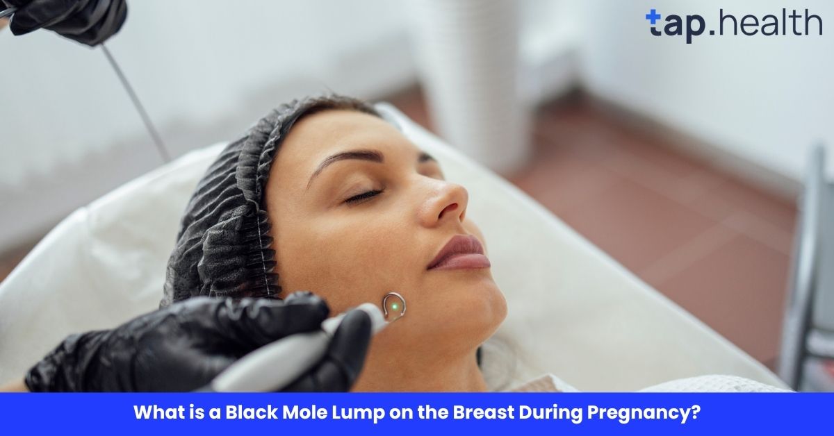 What is a Black Mole Lump on the Breast During Pregnancy?