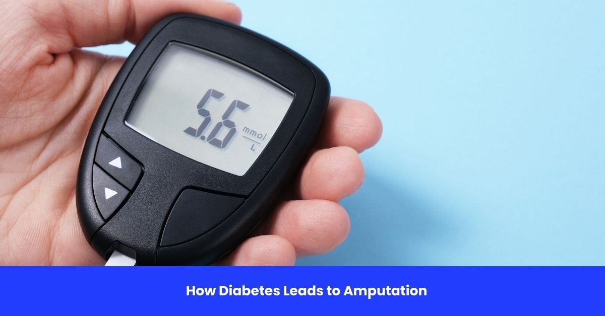 How Diabetes Leads to Amputation