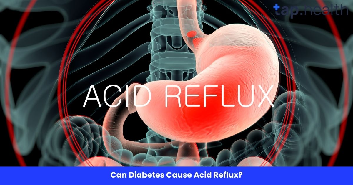 Can Diabetes Cause Acid Reflux?
