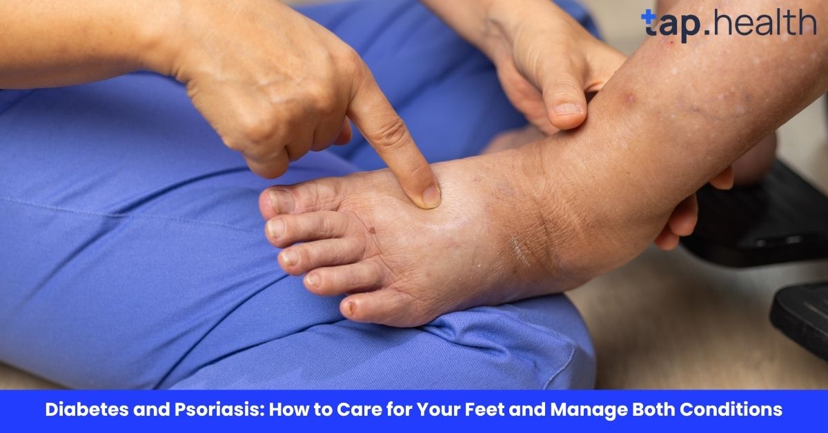 Diabetes and Psoriasis: How to Care for Your Feet and Manage Both Conditions
