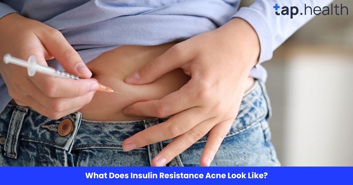 Smartphone Diabetes Management