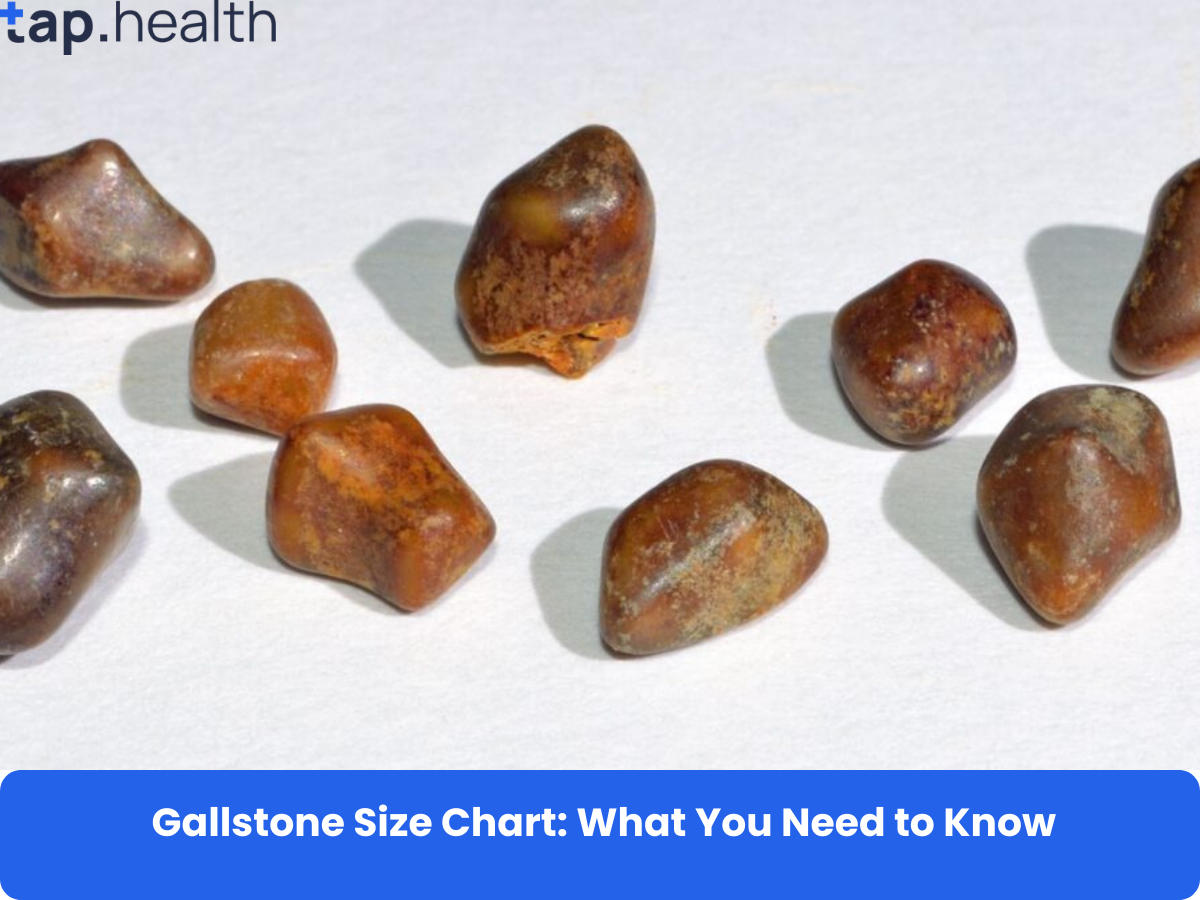 Gallstone Size Chart: What You Need to Know