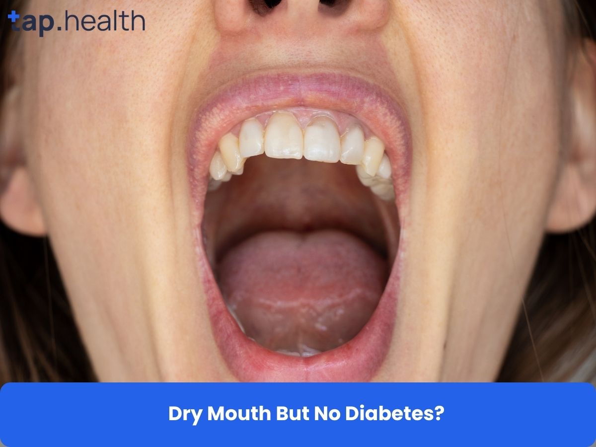 Dry Mouth But No Diabetes?