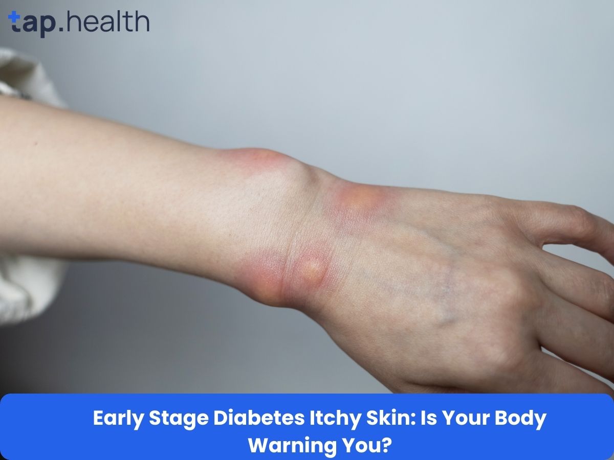 Early Stage Diabetes Itchy Skin: Is Your Body Warning You?