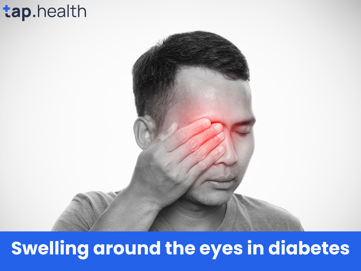 डायबिटीज़ आंखों के आसपास सूजन