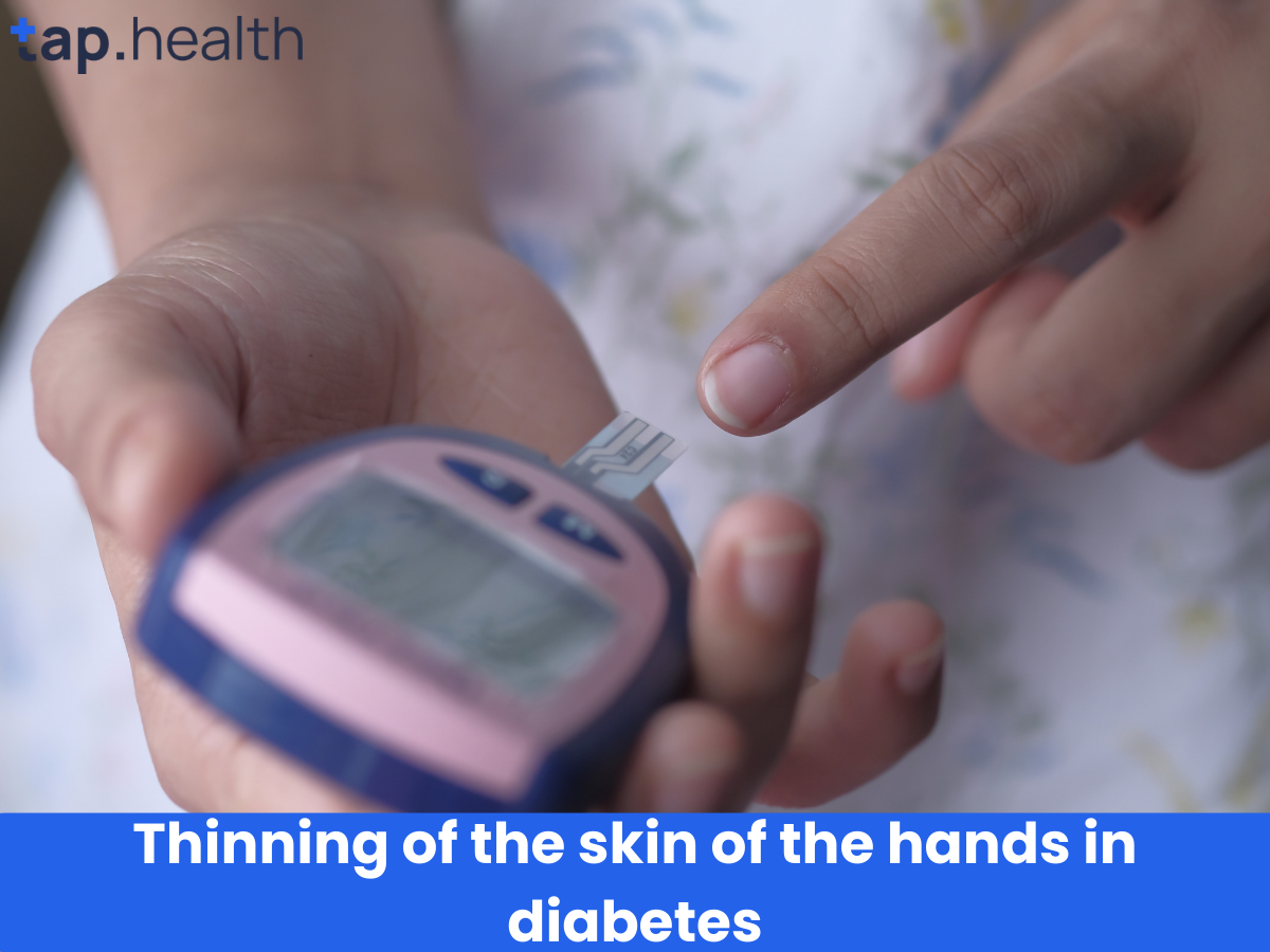 डायबिटीज़ हाथों स्किन पतली