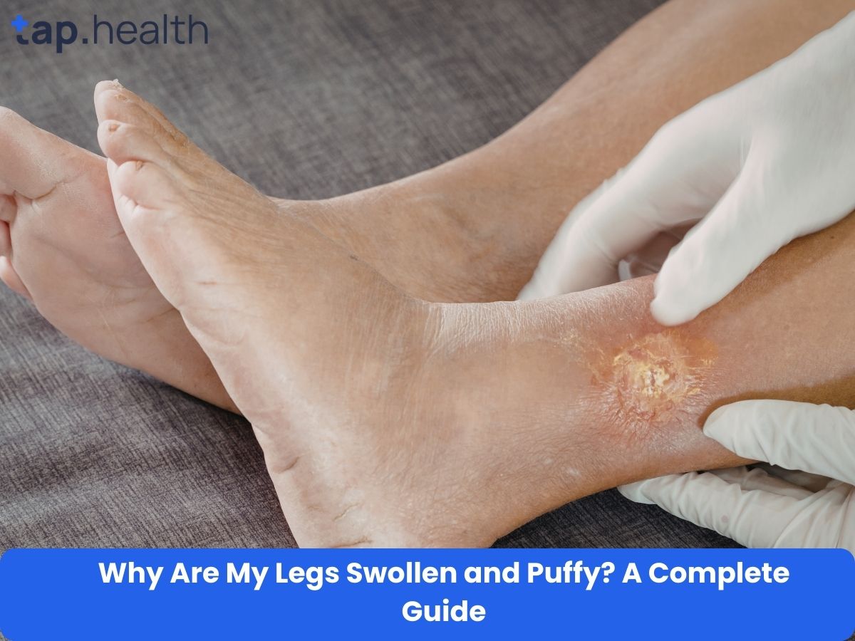 Why Are My Legs Swollen and Puffy A Complete Guide