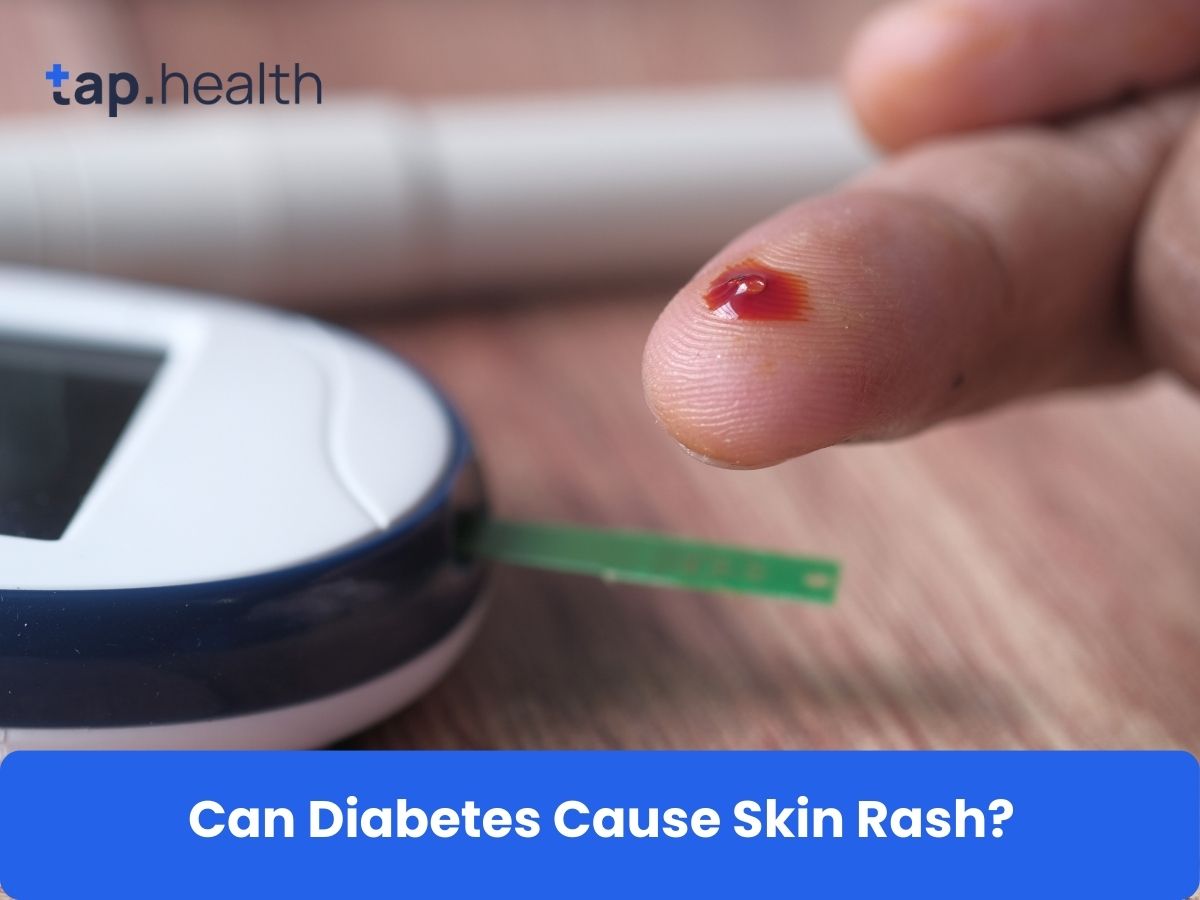 The Impact of Sugar on Thyroid Health: How to Cut Back