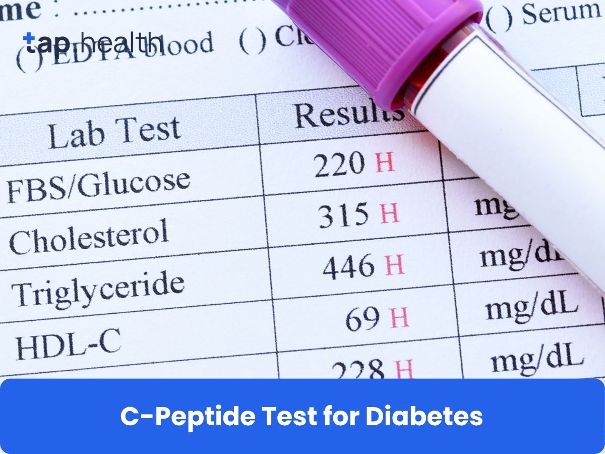 Pre-Diabetic Diet: Easy and Effective Steps for a Healthier You