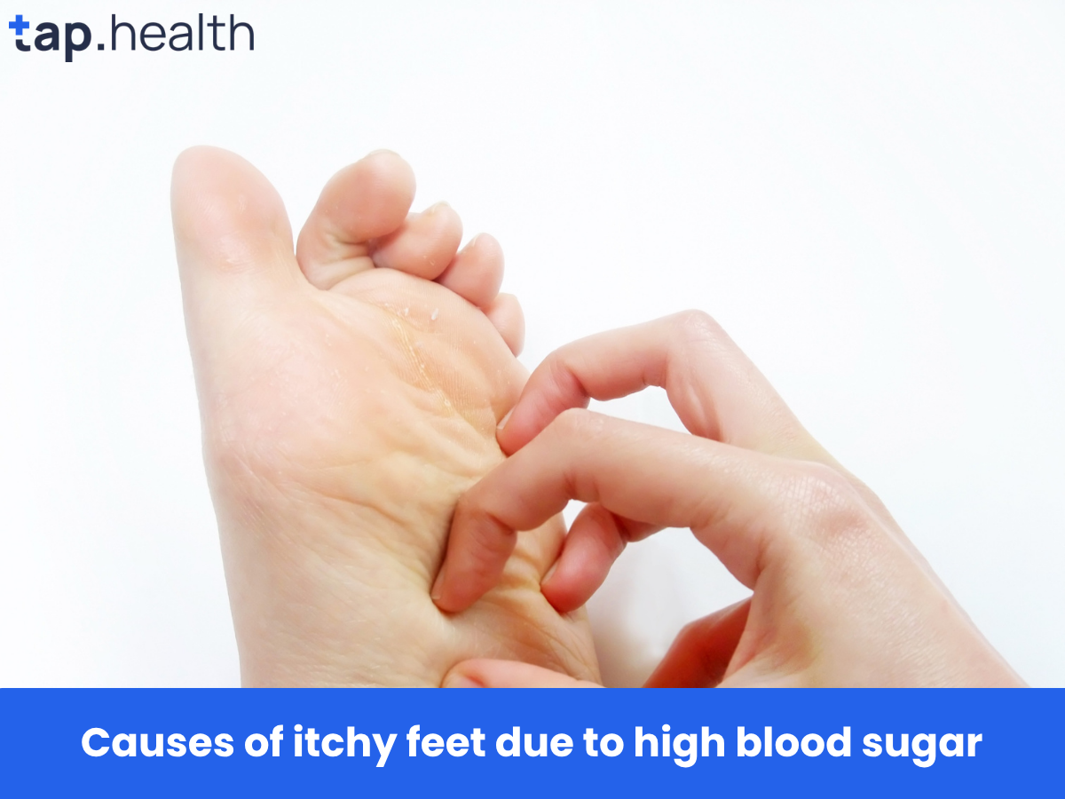 Causes of itchy feet due to high blood sugar