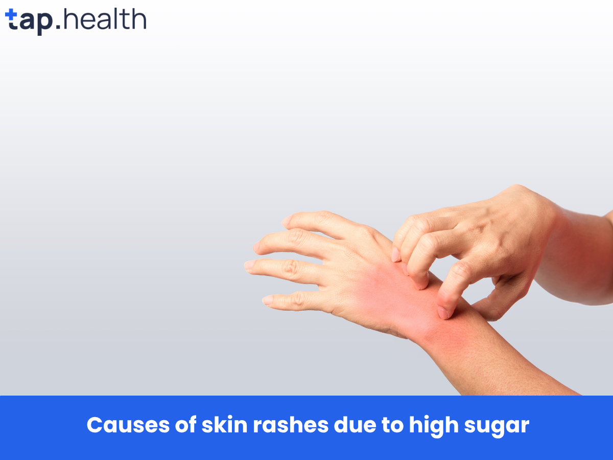 Causes of skin rashes due to high sugar