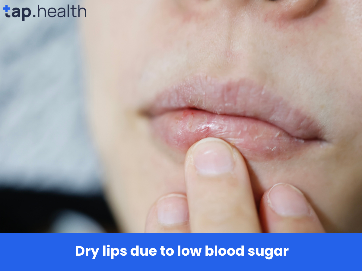Dry lips due to low blood sugar