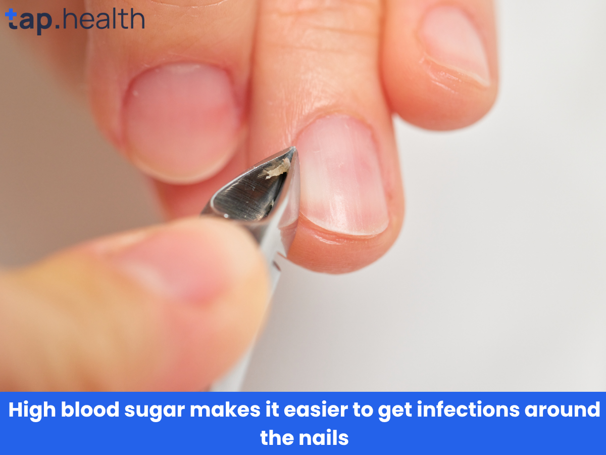 High blood sugar makes it easier to get infections around the nails