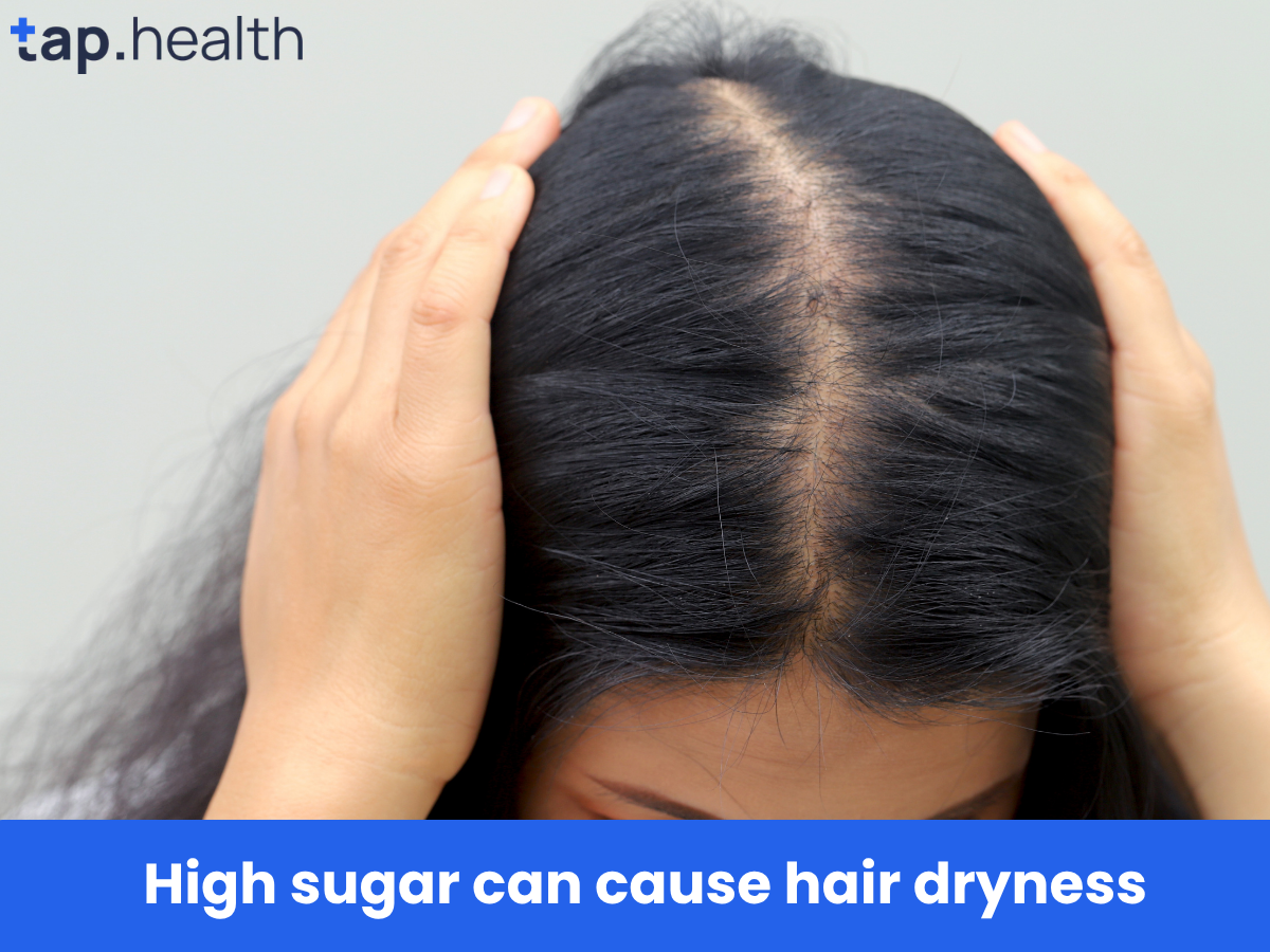 High sugar can cause hair dryness