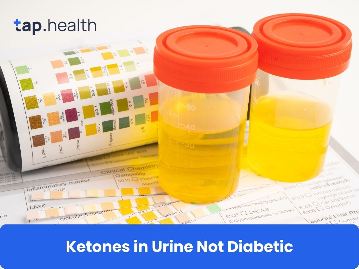 Ketones in Urine Not Diabetic