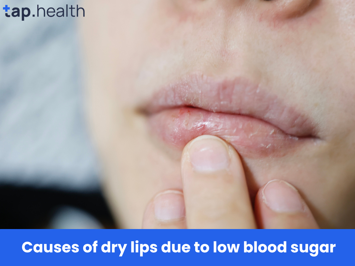 Causes of dry lips due to low blood sugar