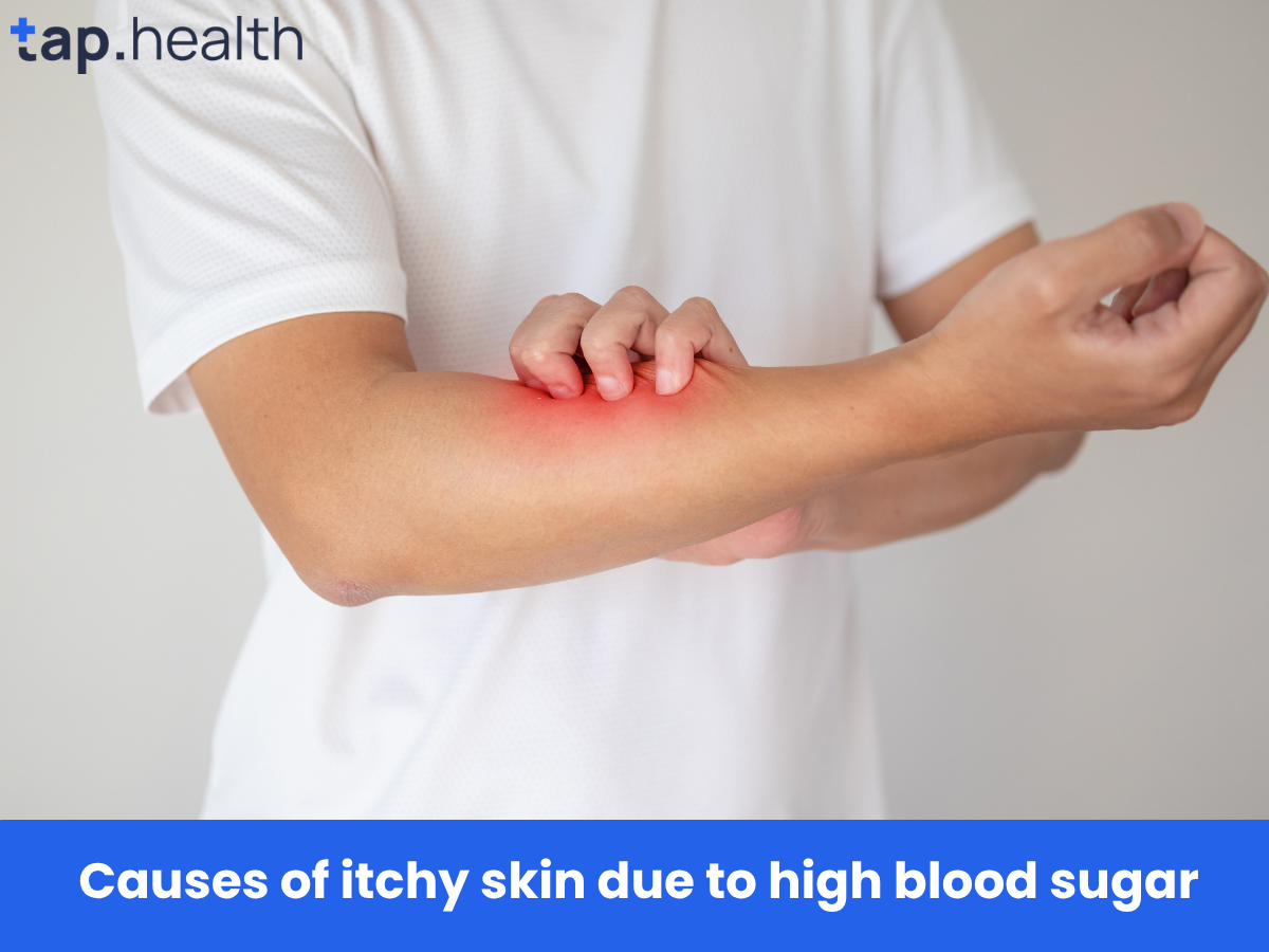 Causes of itchy skin due to high blood sugar