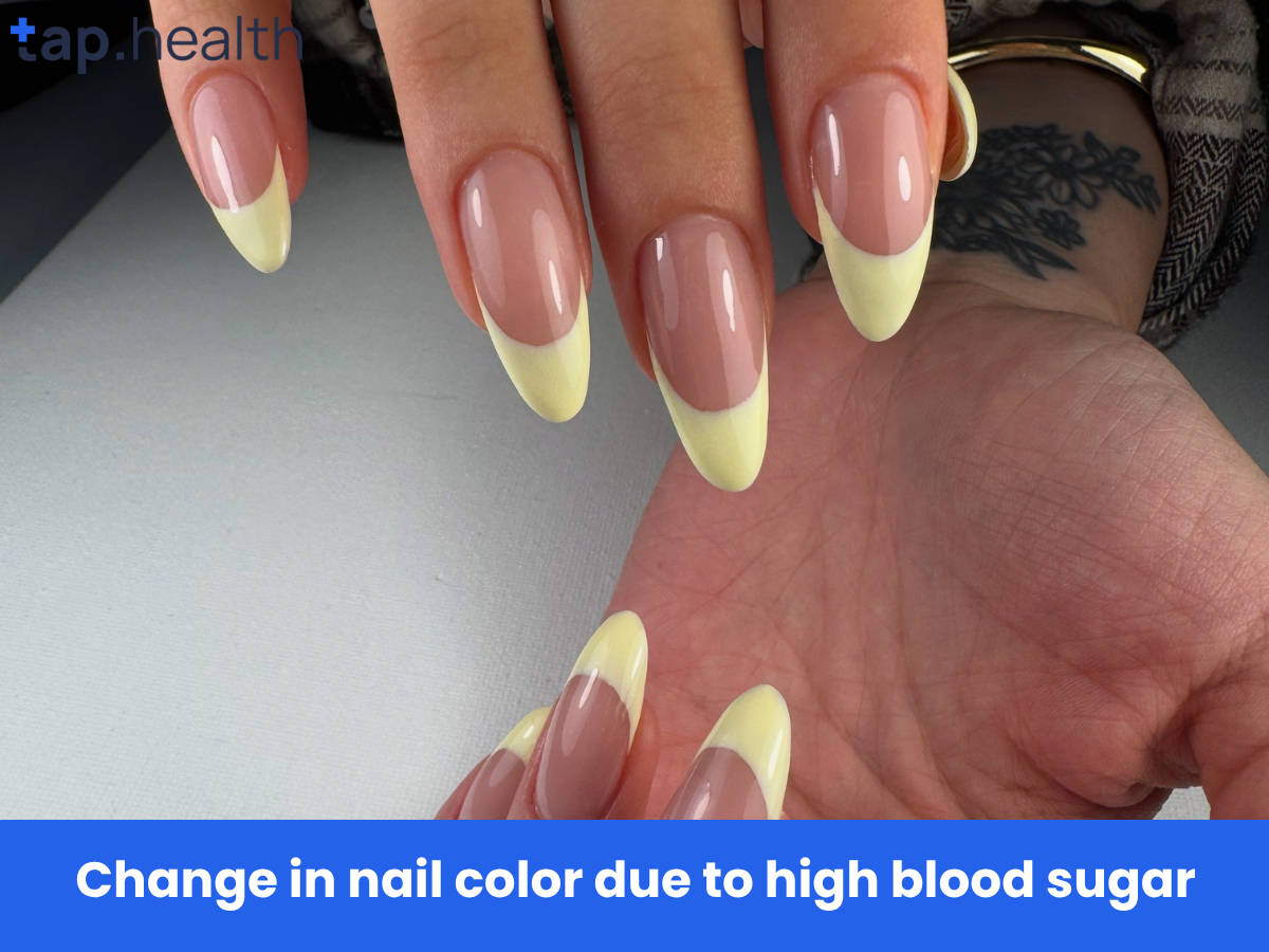 Change in nail color due to high blood sugar