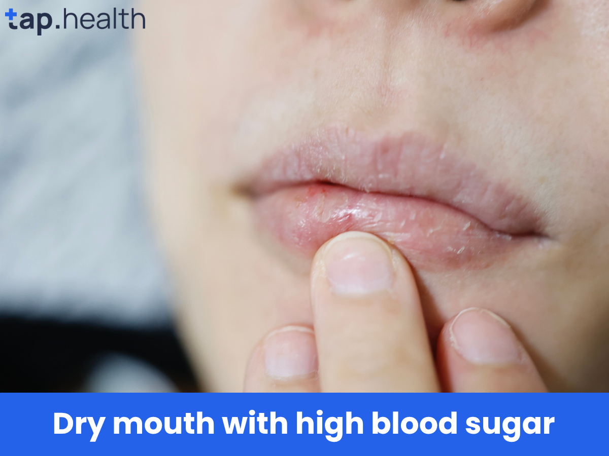 Dry mouth with high blood sugar