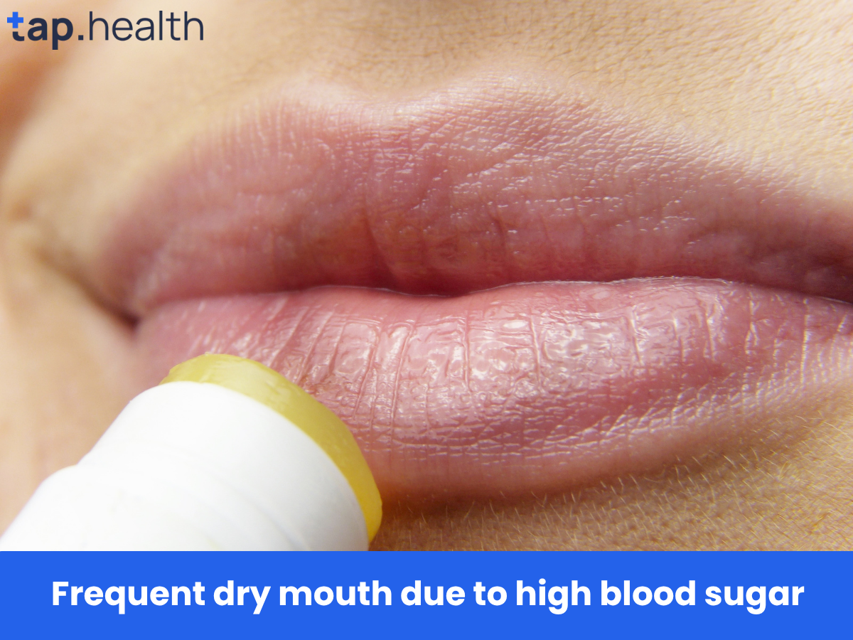 Frequent dry mouth due to high blood sugar