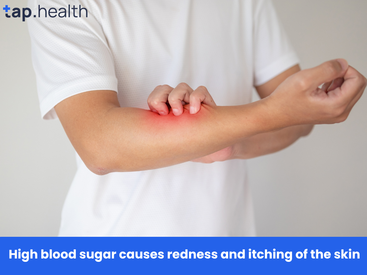 High blood sugar causes redness and itching of the skin